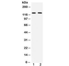 Western blot testing of mouse 1) brain and 2) HEPA lysate with mouse CD11b antibody at 0.5ug/ml. Exp