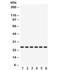 RAB5A Antibody