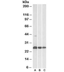 Western blot testing of human [A], mouse [B] and rat [C] heart lysates with DUSP6 antibody at 0.3ug/
