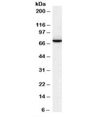 Western blot testing of human lymph node lysate with SWAP70 antibody at 0.1ug/ml. Predicted molecula