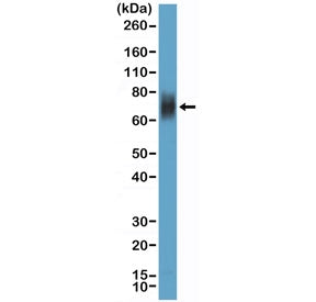Western blot testing of human HL60 cell lysate with recombinant CD33 antibody at 1:100 dilution. Pre