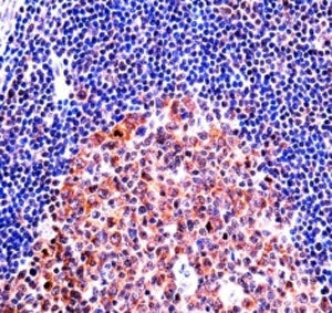 MCM4 antibody immunohistochemistry analysis in formalin fixed and paraffin embedded human tonsil tis