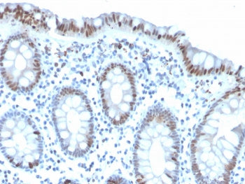 IHC staining of FFPE human colon with recombinant PHH3 antibody. HIER: boil tissue sections in pH 9 