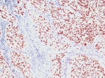 NKX2.1 Antibody / TTF-1