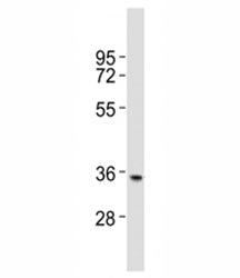 Western blot testing of NANOG antibody at 1:2000 dilution + human brain lysate; Predicted molecular 