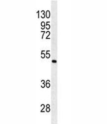 ANGPTL6 Antibody