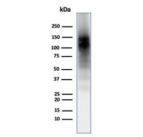 Western blot testing of human brain tissue with CD56 antibody (clone 56C04/123A8). Predicted molecul