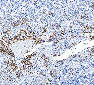 IHC staining of FFPE human tonsil tissue with PD-L1 antibody. HIER: steam section in pH9 EDTA buffer