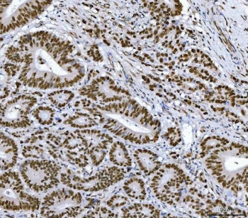 RCC1 Antibody / Regulator of Chromosome Condensation