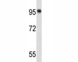 Nucleolin Antibody