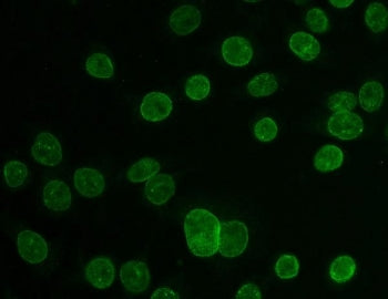 Immunofluorescent staining of FFPE human Caco-2 cells with TPR antibody. HIER: steam section in pH6 