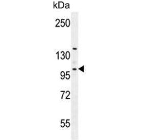 Villin-like protein Antibody / VILL