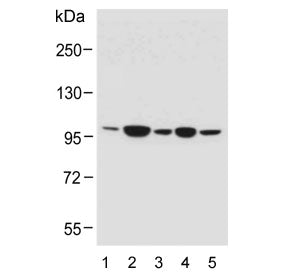 RHBDF2 Antibody