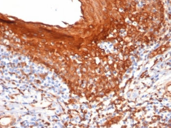 IHC staining of FFPE human tonsil tissue with STING1 antibody (clone STING1/7441). HIER: boil tissue