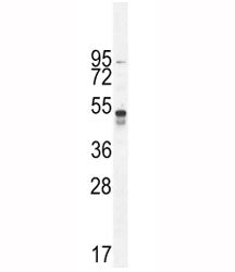 TNFR1 Antibody