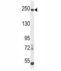L1CAM antibody western blot analysis in mouse cerebellum tissue lysate. Expected molecular weight of