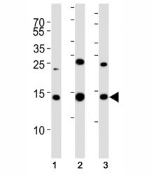 Western blot analysis of lysate from (1) 293T, (2) HL-60, (3) Jurkat cell line using SUMO2 antibody.