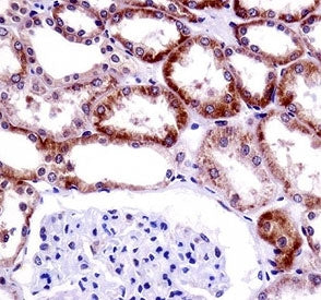 CD70 antibody immunohistochemistry analysis in formalin fixed and paraffin embedded human kidney tis