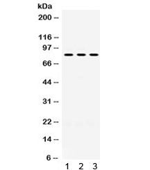 Western blot testing of 1) rat brain, 2) mouse brain, 3) U87 lysate with PAK5 antibody. Expected/obs