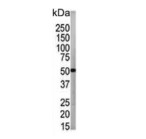 Western blot testing of human CCRF-CEM cell lysate with ATG4B antibody. Expected molecular weight: 3