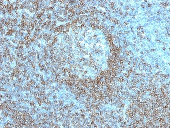 CD45RA Antibody (Leukocyte marker)