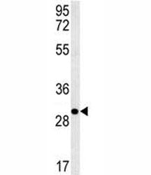 EpCAM Antibody, 0.4ml