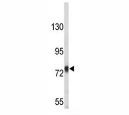 Amyloid beta Precusor Protein Antibody (APP)