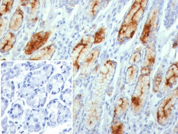 MUC1 Antibody / Mucin-1