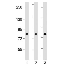 Western blot testing of human 1) HEK293, 2) HT-29 and 3) U-2 OS cell lysate with ADD1 antibody at 1:
