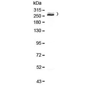 Western blot testing of human HepG2 cell lysate with Desmoplakin antibody at 0.5ug/ml. Predicted mol