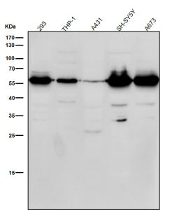 Western blot testing of human samples using the Phospho-Beta Arrestin 1 (Ser412) antibody at 1:1000 