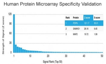 Analysis of HuProt(TM) microarray containing more than 19,000 full-length human proteins using Podop
