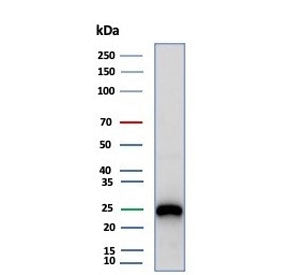 Western blot testing of human Daudi cell lysate with CD79a antibody (clone rIGA/6986). Expected mole