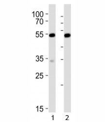 Western blot analysis of lysate from 1) mouse NIH3T3 and 2) rat C6 cell line using Srf antibody at 1