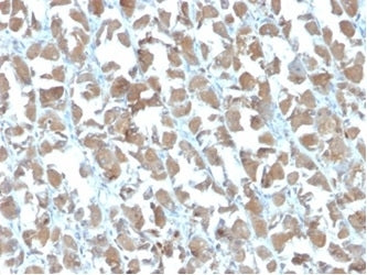 IHC staining of FFPE human stomach with MICA antibody (clone MICA/4442). HIER: boil tissue sections 