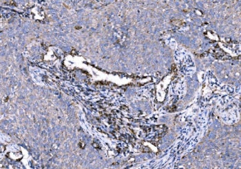 5HT1A Receptor Antibody
