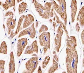 MKRN2 Antibody