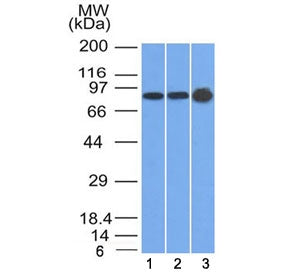 Western blot testing of human 1) U87, 2) HeLa and 3) A431 cell lysate with Plakophilin 1 antibody (c