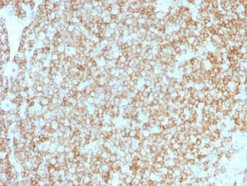 CD45 Antibody Cocktail (Leukocyte marker)