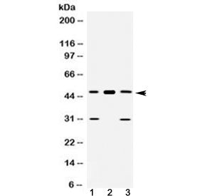 Western blot testing of 1) rat liver, 2) mouse heart and 3) human U-2 OS lysate with E2F3 antibody a
