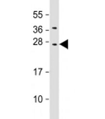 Western blot testing of human HepG2 cell lysate with CIDE B antibody at 1:2000. Predicted molecular 