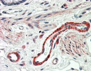 THBS3 Antibody
