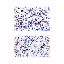 CD57 / HNK-1 Antibody