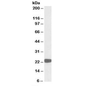 Western blot testing of HepG2 lysate with PRDX1 antibody at 0.01ug/ml. Predicted molecular weight: 2