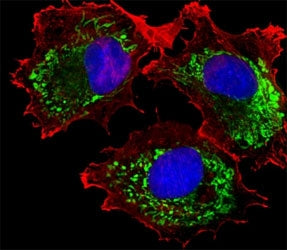 ALDH6A1 Antibody