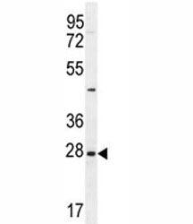 EDN3 Antibody