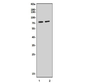Narc1 Antibody / Neural apoptosis-regulated convertase 1 / Pcsk9