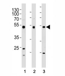 Western blot analysis of lysate from (1) HepG2, (2) HT-29, and (3) SW620 cell line using FOXA2 antib