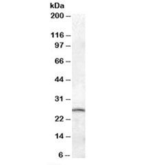 Western blot testing of mouse brain lysate with PSPH antibody at 0.05ug/ml. Predicted/observed molec