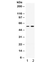 Western blot testing of 1) rat skeletal muscle and 2) human MCF7 lysate with ACVR2B antibody at 0.5u